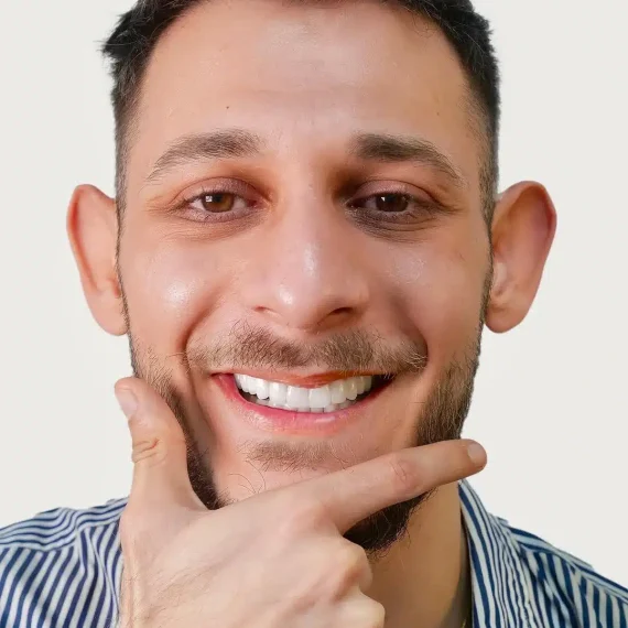 Hollywood Smile'ın Avantajları Nelerdir